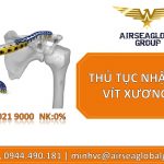 THỦ TỤC NHẬP KHẨU VÍT XƯƠNG Y TẾ