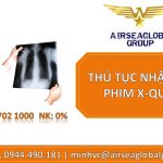 THỦ TỤC NHẬP KHẨU PHIM X-QUANG