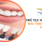 thu tuc nhap khau mau nhuom rang su