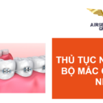 thu tuc nhap khau mac cai chinh nha