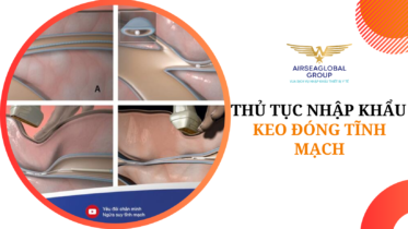 thu tuc nhap khau keo dong tinh mach