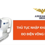 thu tuc nhap khau may do dien vong mac