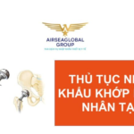 thu tuc nhap khau khop hang nhan tao