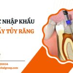 TRÁM LẤY TỦY RĂNG
