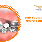 thu tuc nhap khau minivis chinh nha