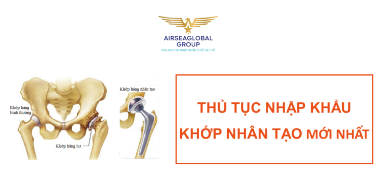 thu tuc nhap khau khop nhan tao