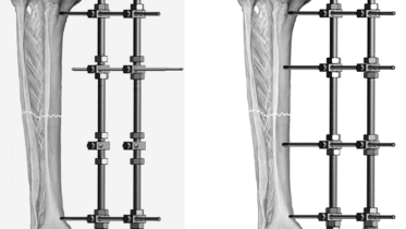 thu tuc nhap khau dinh nep vit